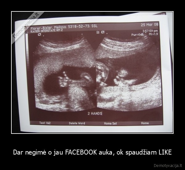 Dar negimė o jau FACEBOOK auka, ok spaudžiam LIKE