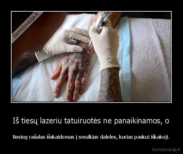 faktas,lazerinis, tatuiruociu, naikinimas