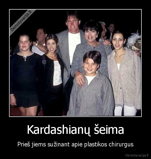 plastine, chirurgija,kardashian