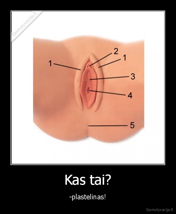 Kas tai?