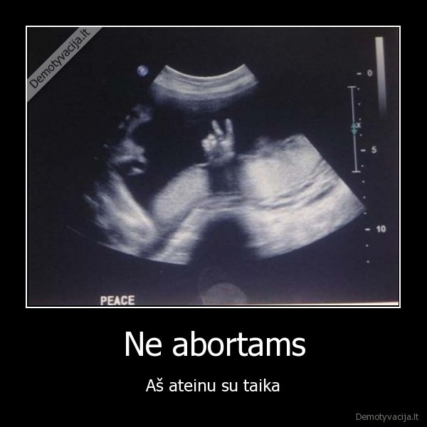ne, abortams