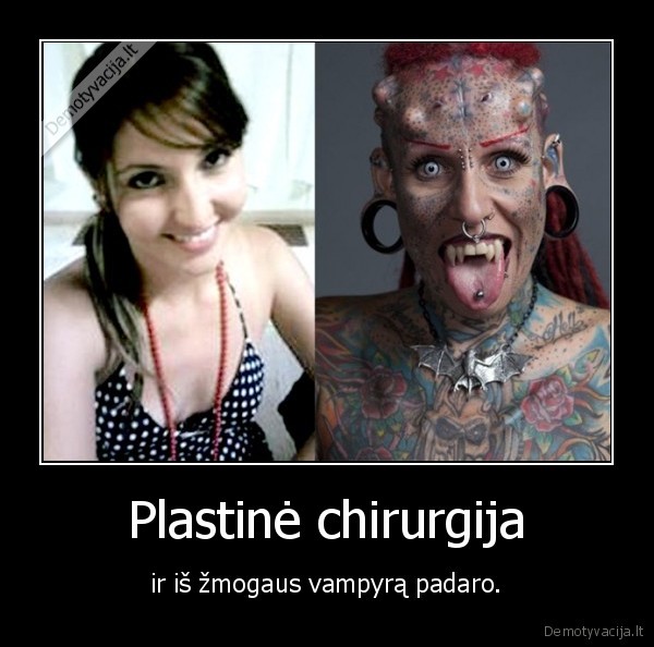 Plastinė chirurgija