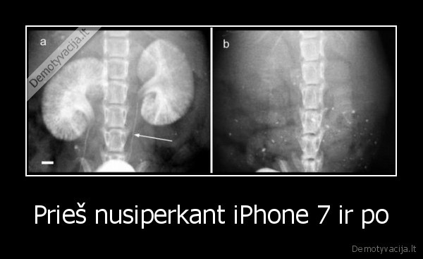 Prieš nusiperkant iPhone 7 ir po