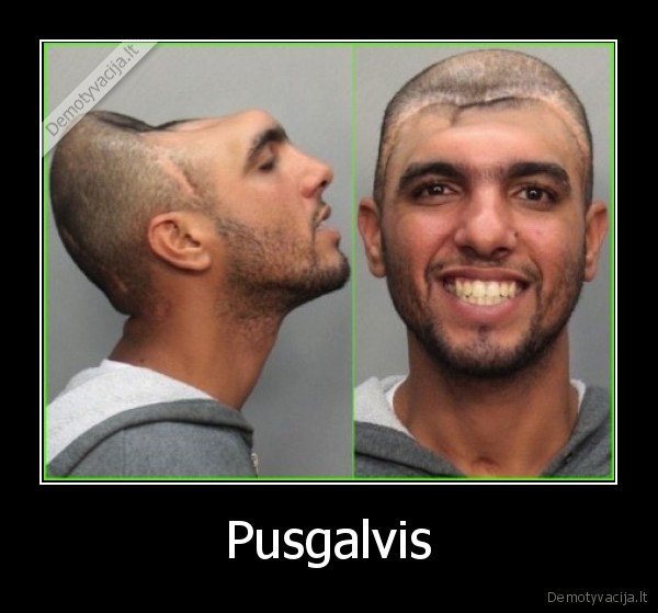 pusgalvis