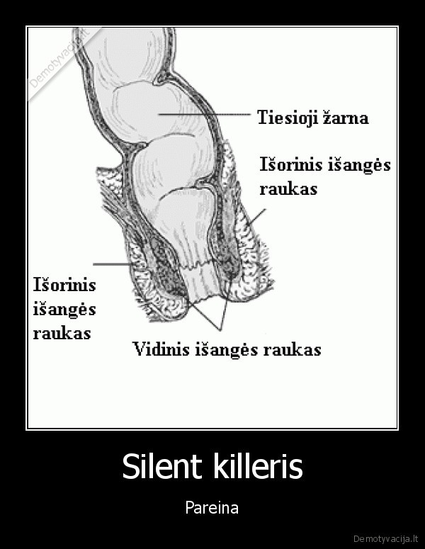 Silent killeris