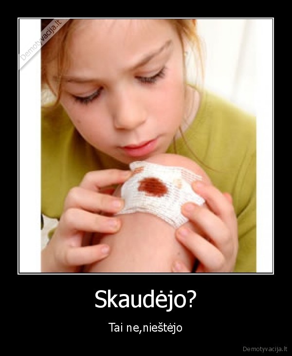 Skaudėjo?