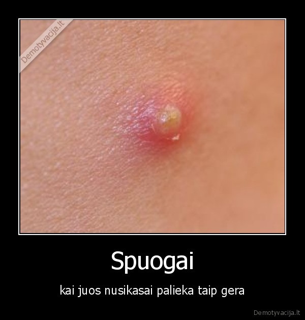 Spuogai