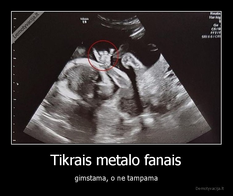 metalas,fanas,vaikas,gimsta