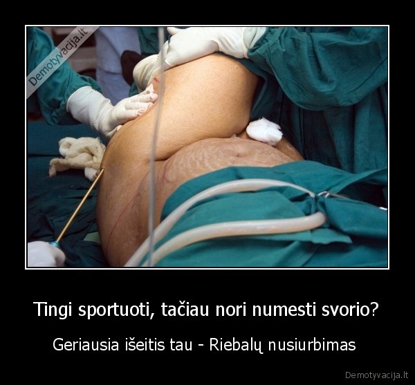 Tingi sportuoti, tačiau nori numesti svorio?