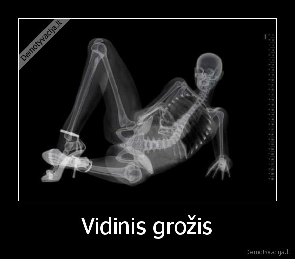 Vidinis grožis