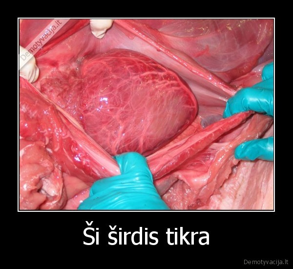 Ši širdis tikra