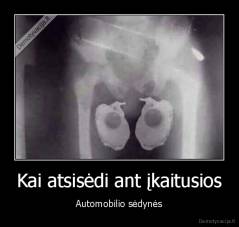 Kai atsisėdi ant įkaitusios - Automobilio sėdynės