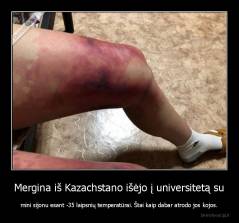 Mergina iš Kazachstano išėjo į universitetą su - mini sijonu esant -35 laipsnių temperatūrai. Štai kaip dabar atrodo jos kojos.
