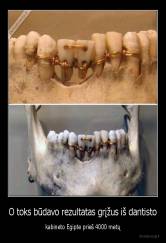 O toks būdavo rezultatas grįžus iš dantisto - kabineto Egipte prieš 4000 metų