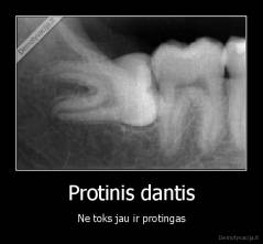 Protinis dantis - Ne toks jau ir protingas