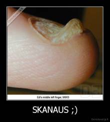 SKANAUS - 