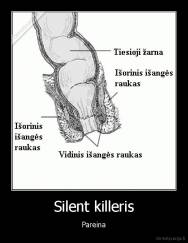 Silent killeris - Pareina