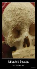 Tai kaukolė žmogaus - Kuris sirgo kaulų vėžiu