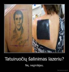 Tatuiruočių šalinimas lazeriu? - Ne, negirdėjau.