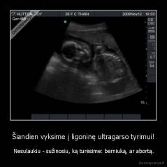 Šiandien vyksime į ligoninę ultragarso tyrimui! -  Nesulaukiu - sužinosiu, ką turėsime: berniuką, ar abortą.