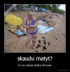 skaudu matyt? - tu ne vienas dietos žinovas